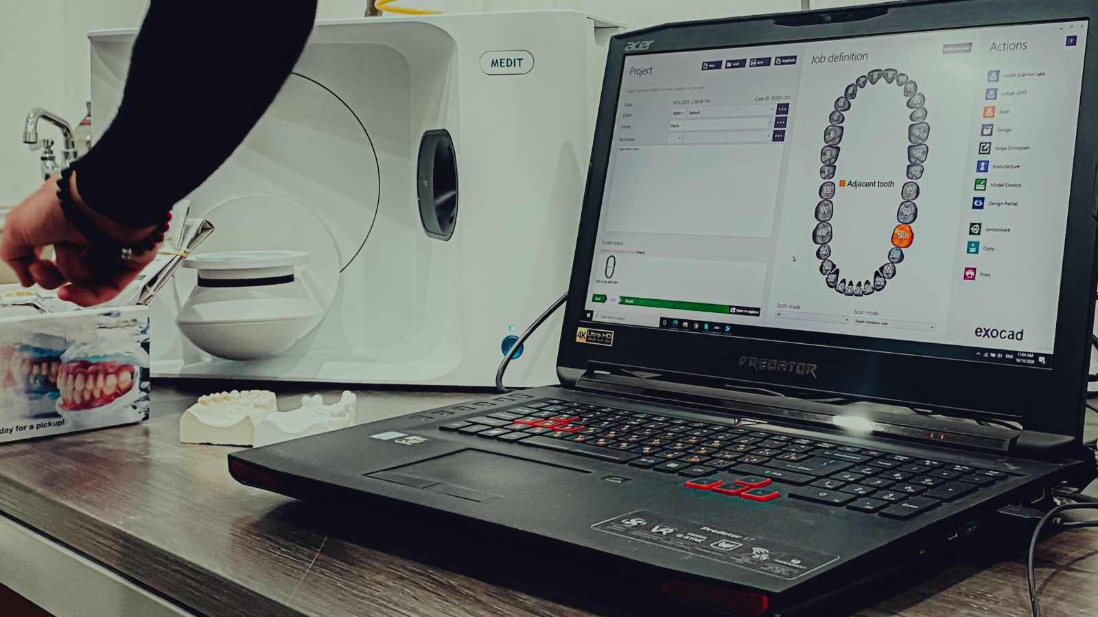 Digital workstation in the Integra Dental milling center, where scans become milled restorations