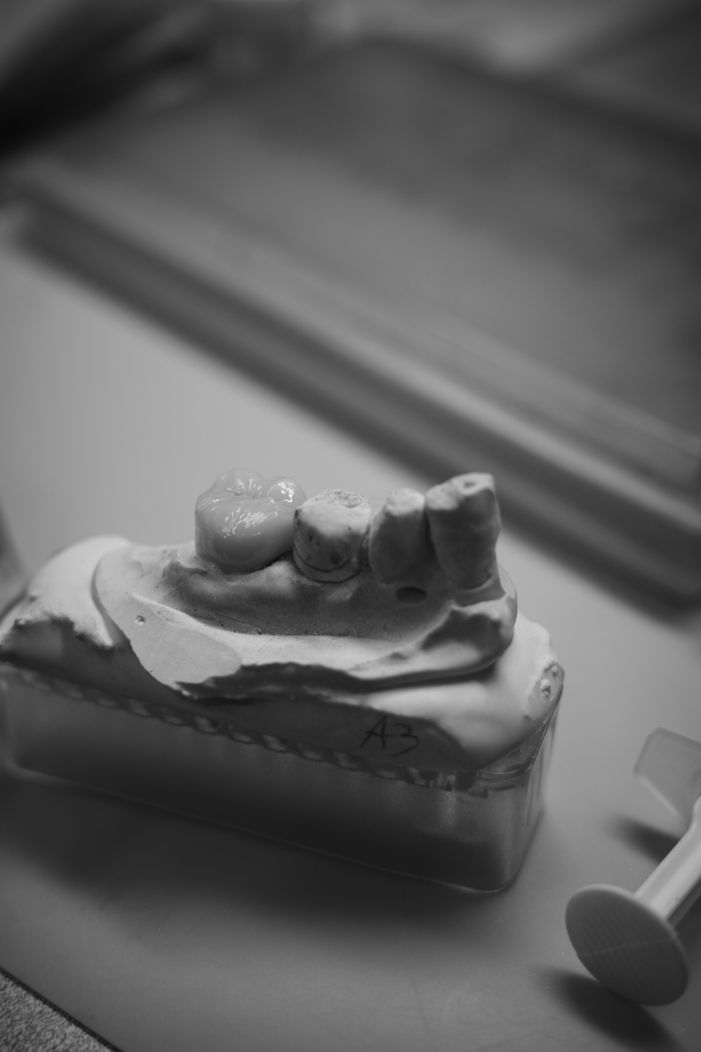 Anterior zirconia bridge on stone die model