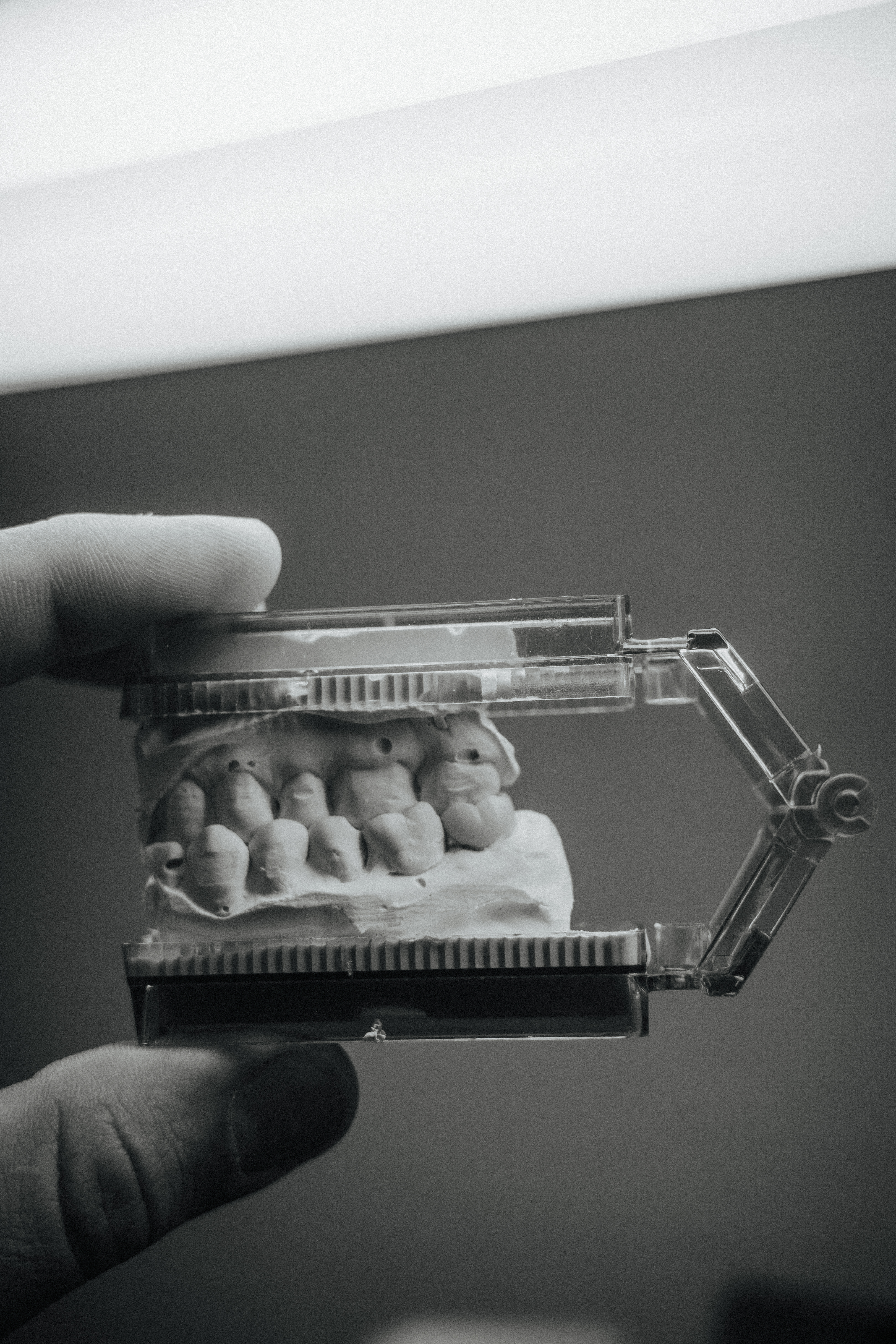 Ti-base abutment prep model