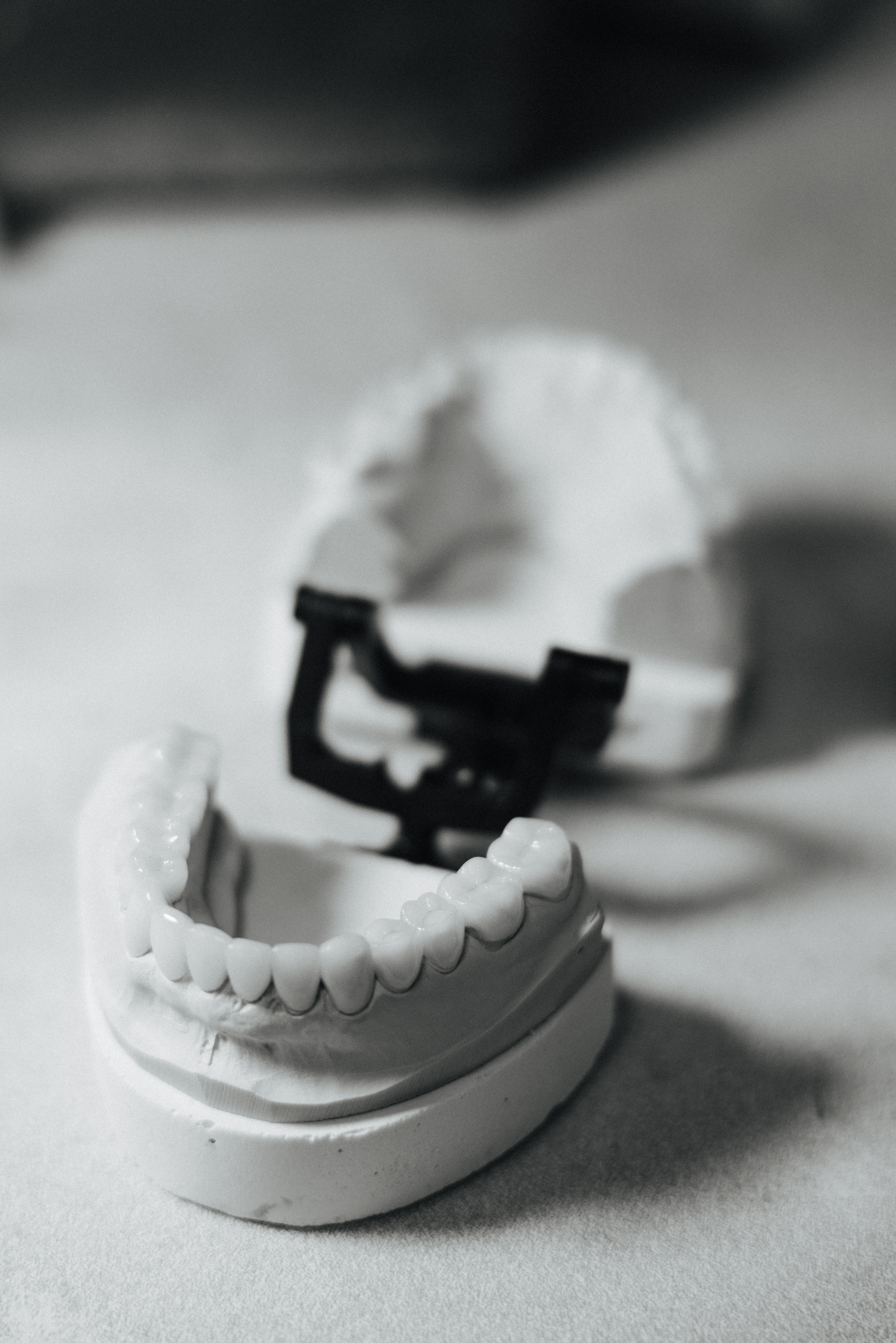 Full-arch E.max restoration