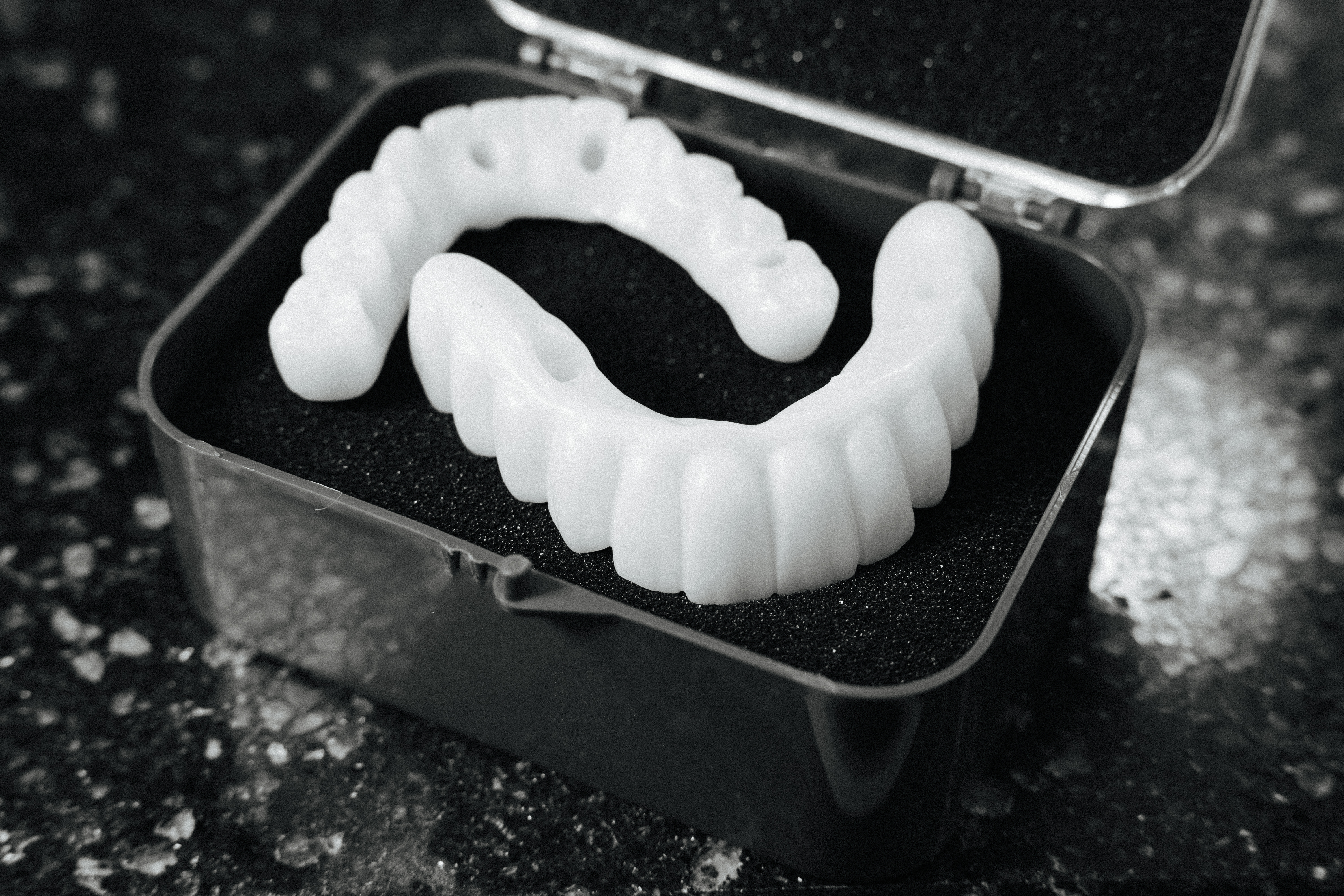 Full-arch zirconia hybrid bridge