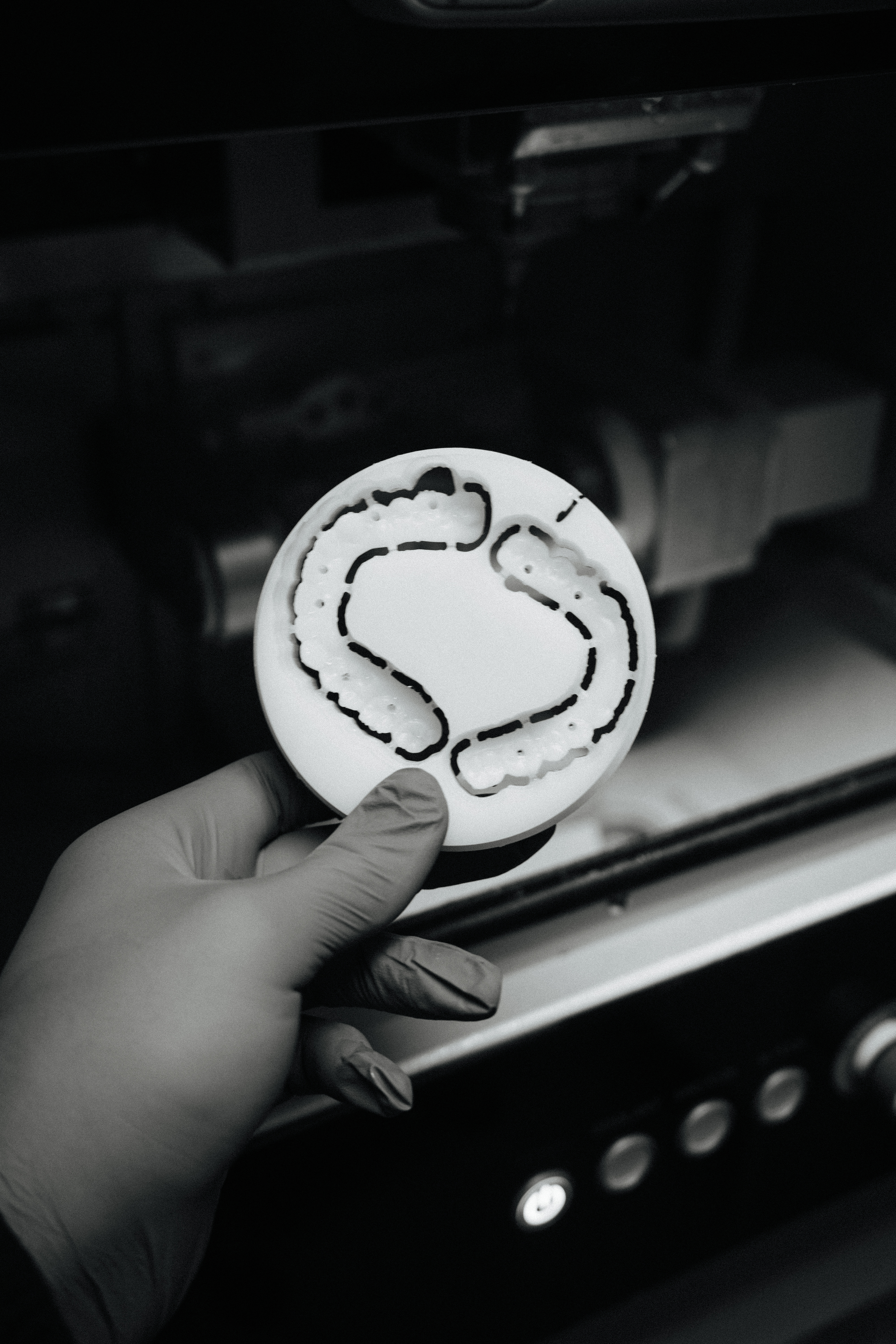 Milled PMMA try-in provisional