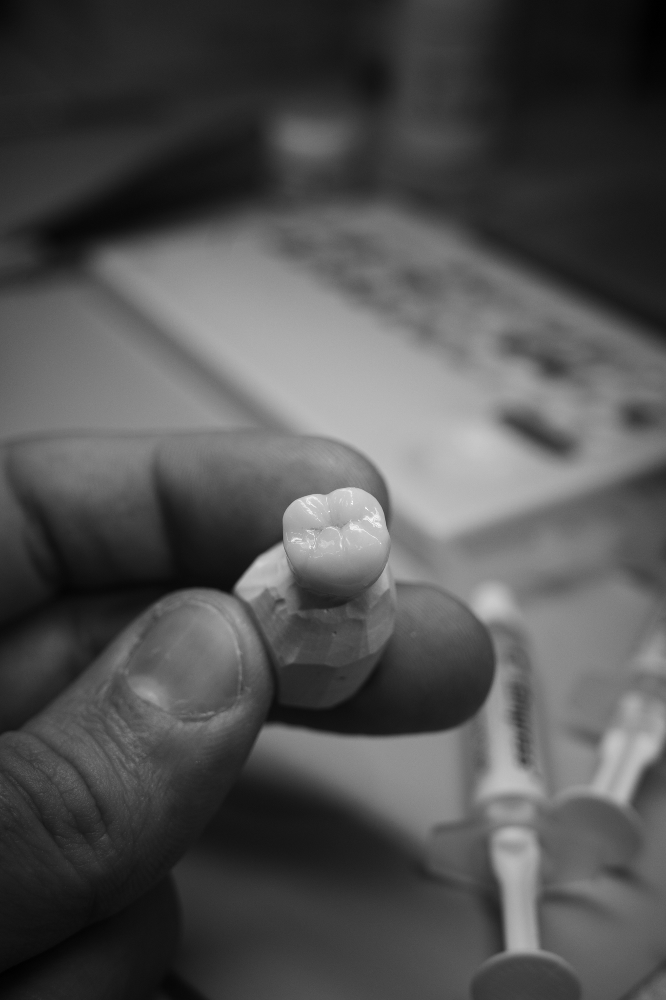 Monolithic E.max molar crown