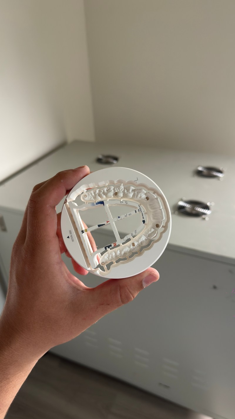 Technician holding a milled full-arch restoration in its disc
